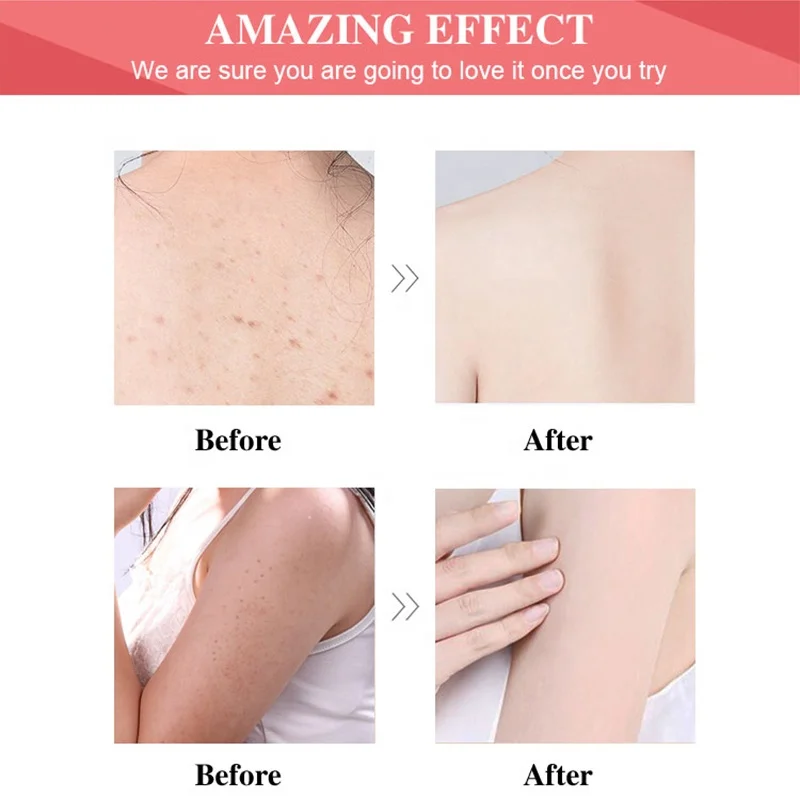 Private Label Organic Shea Butter Sugar Stretch Marks Bath And Works Coco Hydrating Exfoliating Salt Shea Sugar Body Scrub