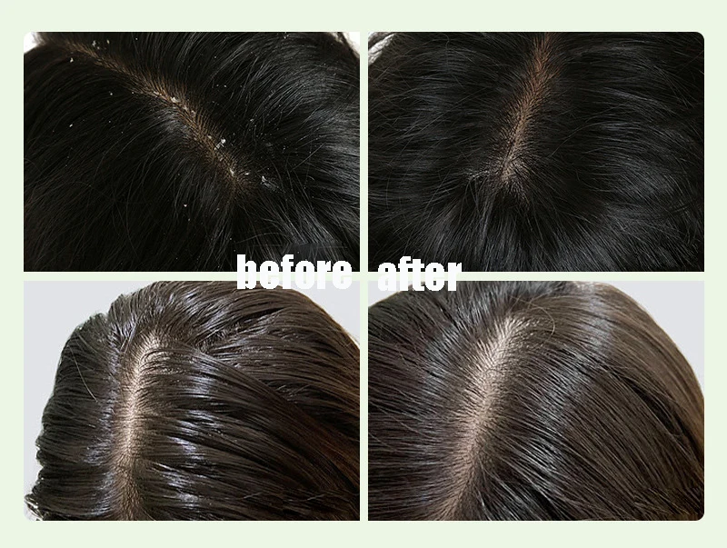 Wholesale natural organic sulphate free organic anti hair fall loss shampoo watermelon tea tree oil Shampoo And Conditioner Set
