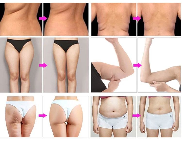 3 в 1 presoterapia излучение в дальнем инфракрасном диапазоне лимфодренаж ems мышечный Стимулятор прессотерапия машина