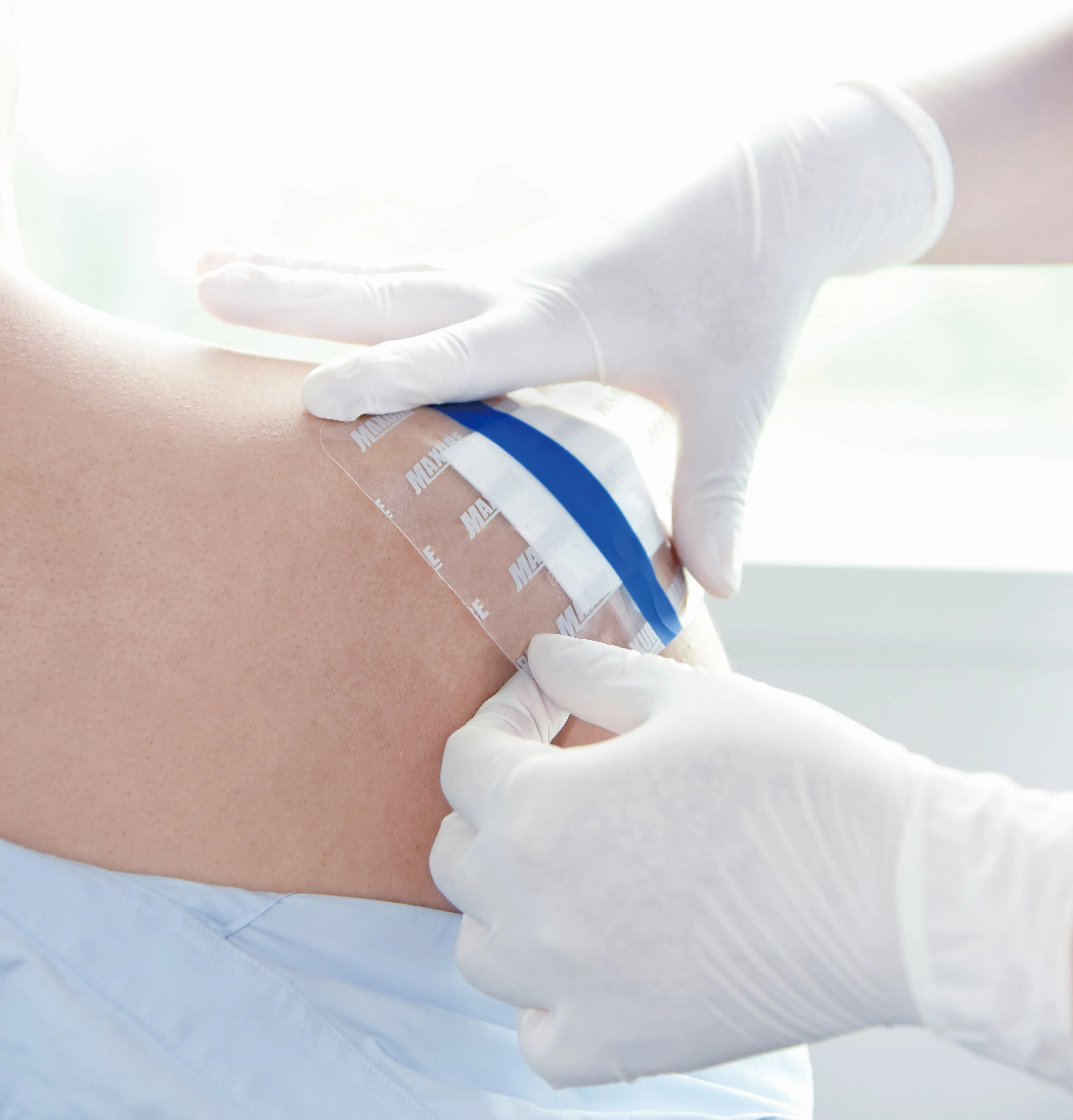 Waterproof Transparent Wound Dressing for Wound Healing