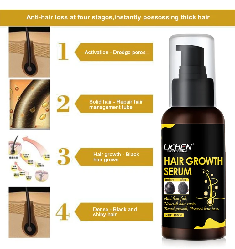 Лучший результат, сыворотки для быстрого роста волос ginger, Органическая натуральная формула, оптовая продажа для афроамериканских волос