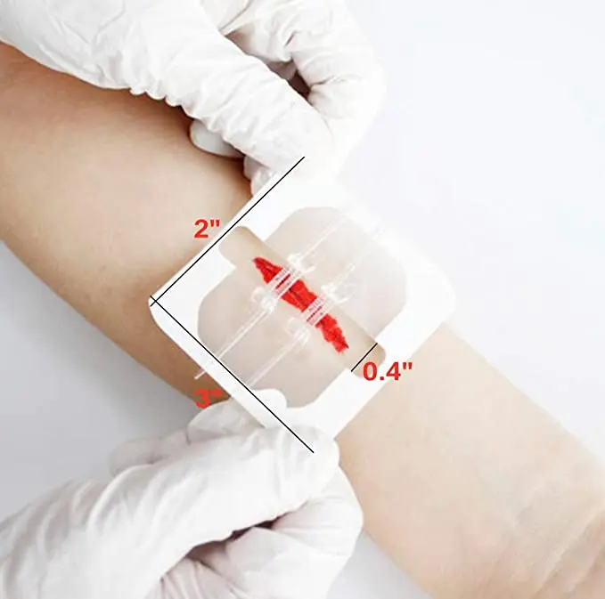 OEM package Skin closure strip wound closure device strips with PU dressing wound zipper