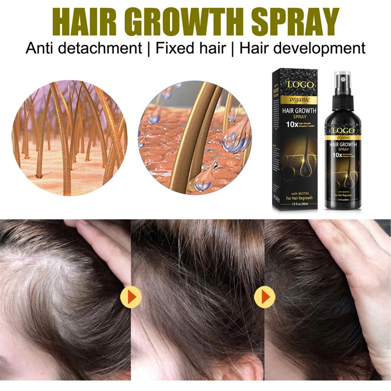 Unlock Vibrant Hair with Black Rice water Hair Growth Spray and Hair Growth Spray  OEM