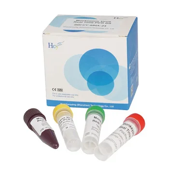 2022 Mpv Antigen Agent Test Kit Monkeypox Pcr Detection Reagent Kit Monkeypox Nucleic Acid Test Kit