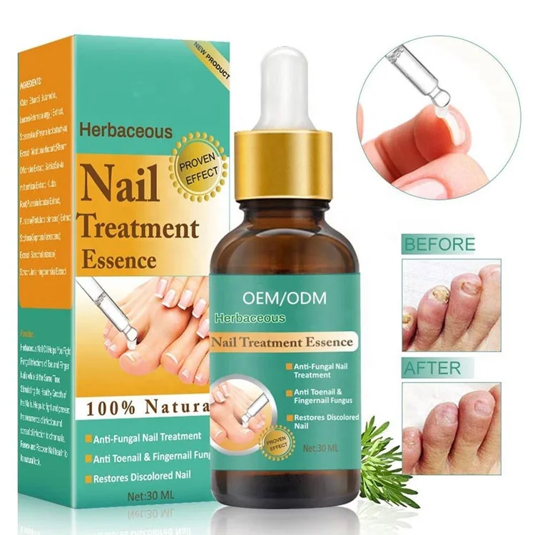 OEM Anti Fungal Treatment Finger Gel Beauty Care Nail