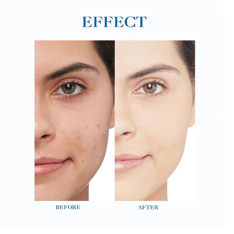 Facial Skin Care Plumping Wrinkles And Erasing Fine Lines Removal Acne Marks Face Serum