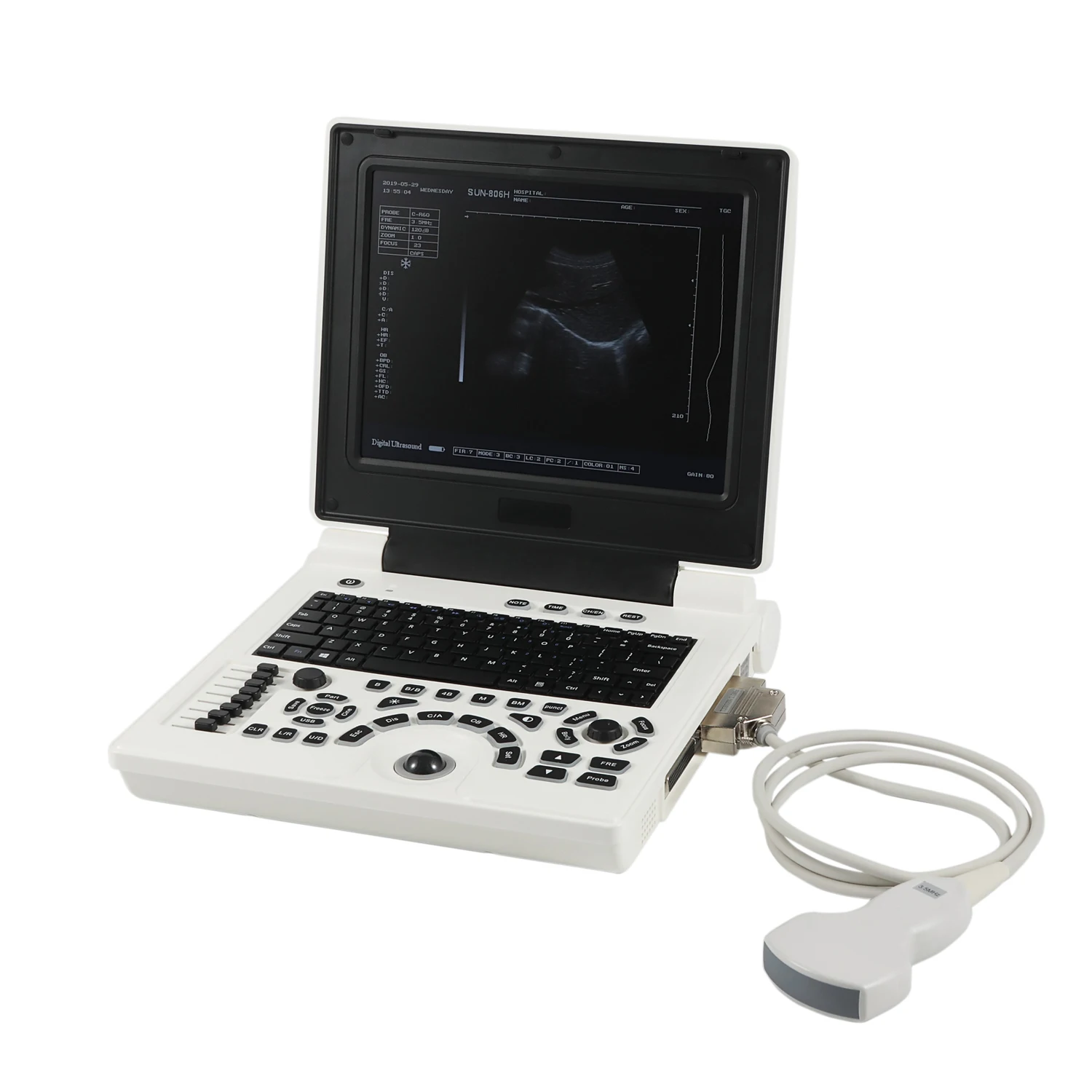Medical Diagnostic B&W Portable Ultrasound Machine Ultrasound Scanner For Sale