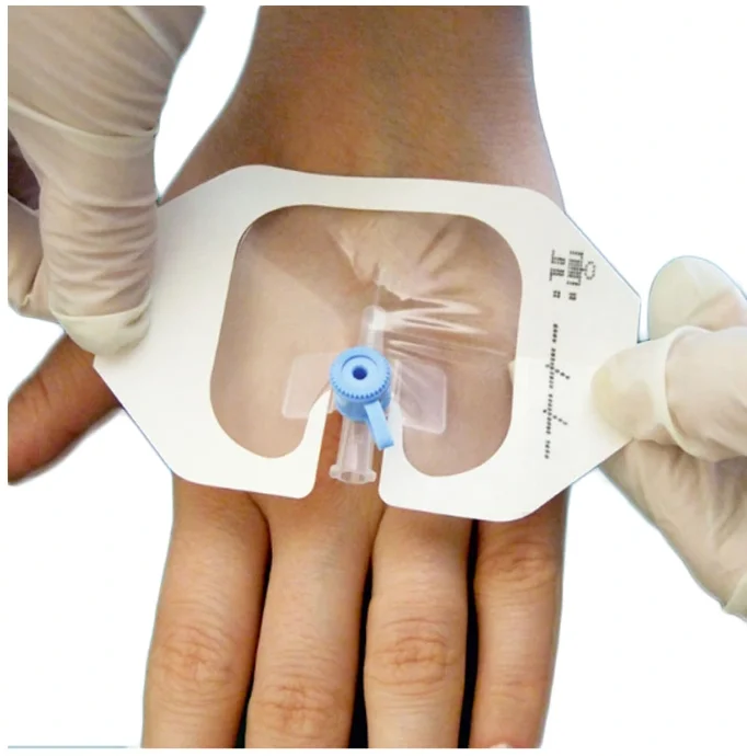 Disposable Medical Dressing Breathable Waterproof Wound Transparent Film Pad Cannula Medical Fixation I.V Cannula Dressing