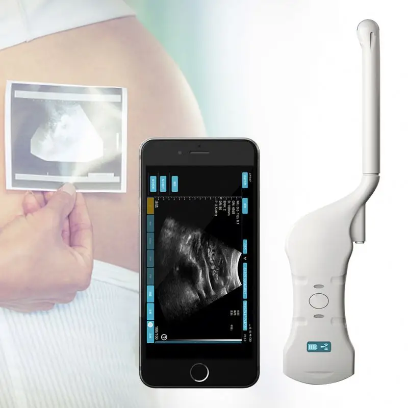 Medical Imaging Equipment Portable wireless wifi ultrasound scanner transvaginal ultrasound probe wireless