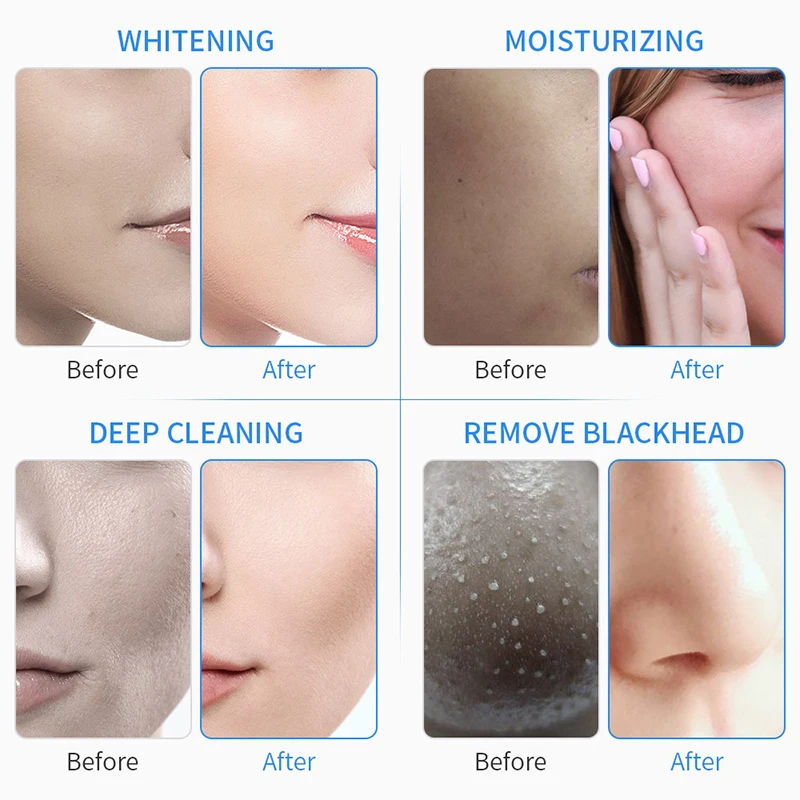 Professional Beauty Electric Diamond Peeling Oxygen Jet Hydrogen Oxgen Facial Diamond Microdermabrasion Machine