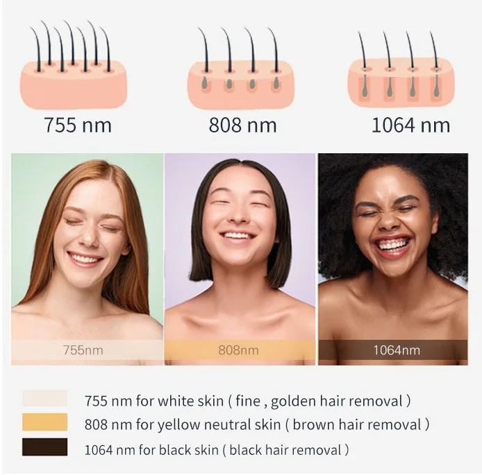 Tuv Medical Ce Certified Laser Diode 808nm Beauty Salon Equipment Device 2022 Alma 2000w Permanent 808nm Diode