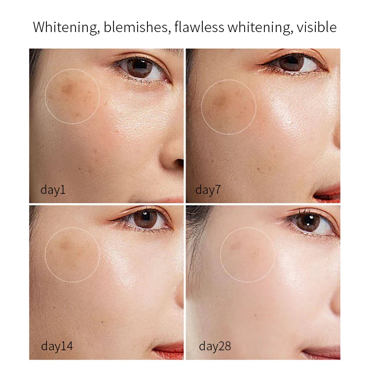 OEM Hot Sale Face Cream Dark Spot Corrector Skin Care refreshments Whitening Freckle Removing Cream