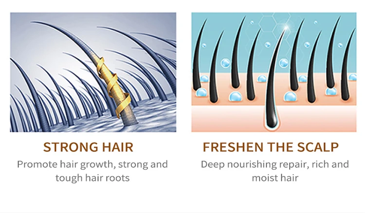 SEVICH ginger anti hair loss regrowth hair treatment shampoo