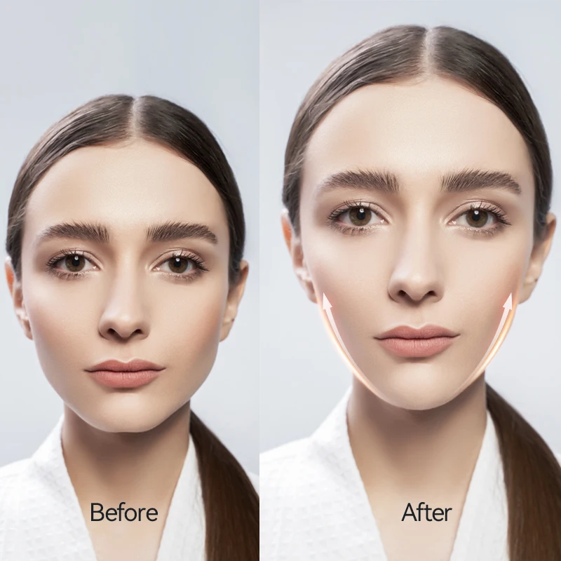 New 2021 Beauty Electric V-face Lifting Massager Face Lifting V Shaping Face-lifting Slimmer Slimming
