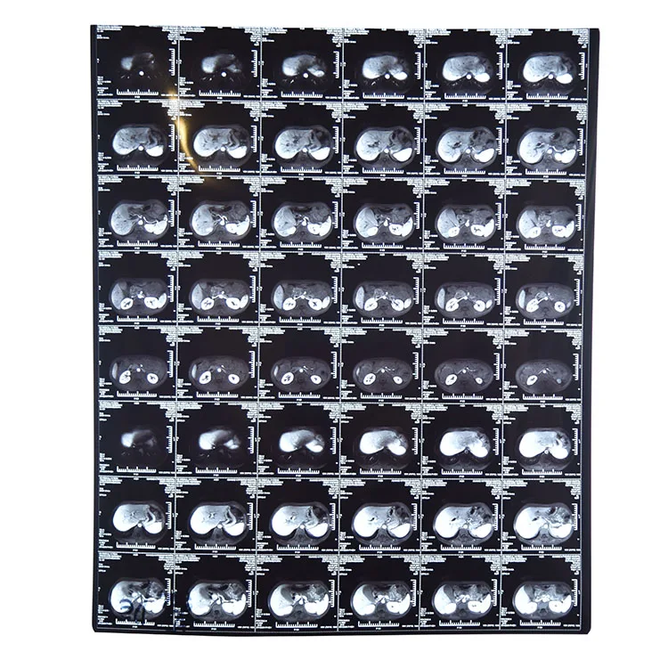 Hengcai Medical Dry Imaging Film Fuji X Ray Dry 10 X 12 Inch Inkjet & Fuji Printing Medical X-Ray Film