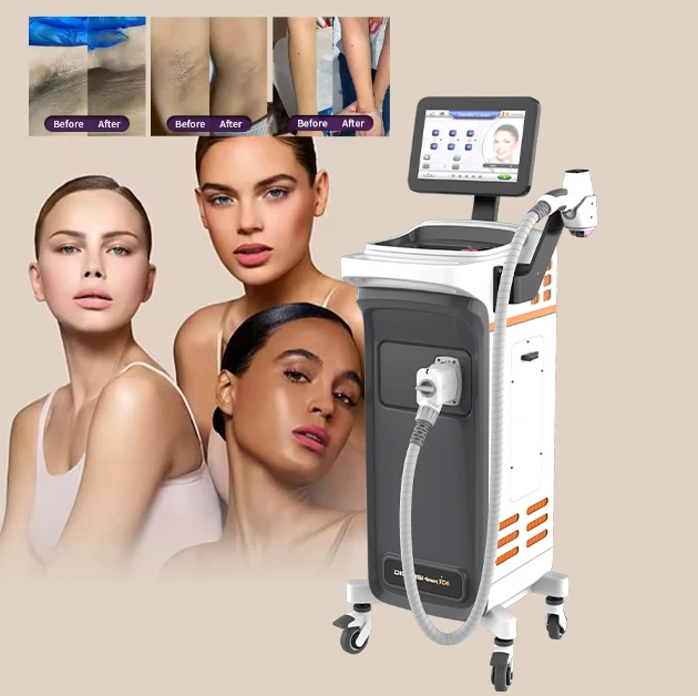Beijing nubway laser 4 diode women hair removal 808 beauty machine for commercial salon
