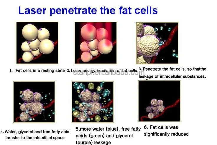 Mini Portable 6d Lipolaser Body Slimming Liposuction Laser 210mw High Power Diode Laser Lamp Lipo Laser 5D Paddle Weight Loss