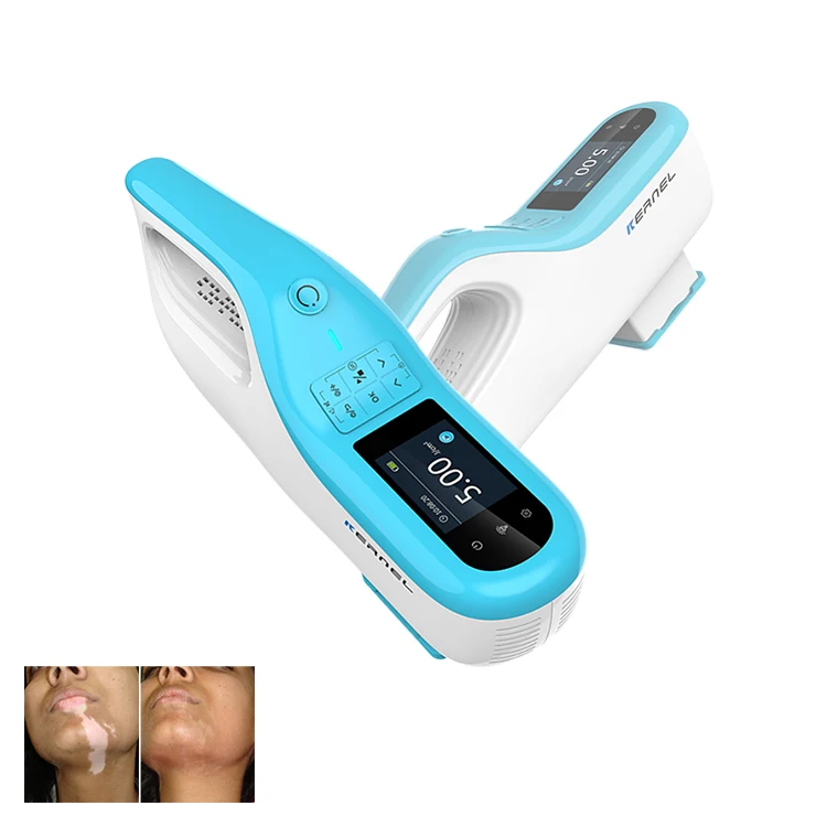 uv curing machine portable 2024 hot Portable Excimer Laser 308nm Vitiligo Treatment home phototherapy light therapy uv lamp