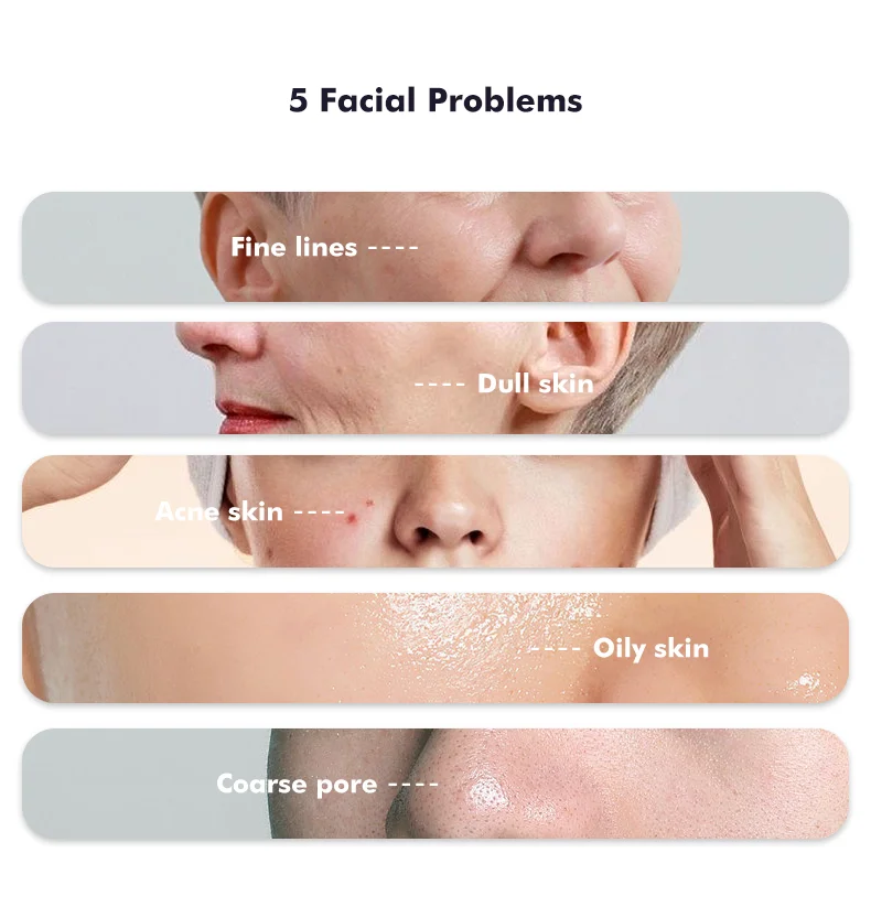 Trending Products 2022 New Arrivals Home Use Handheld Facial Face Lift Devices Anti Aging Wrinkle Beauty Device