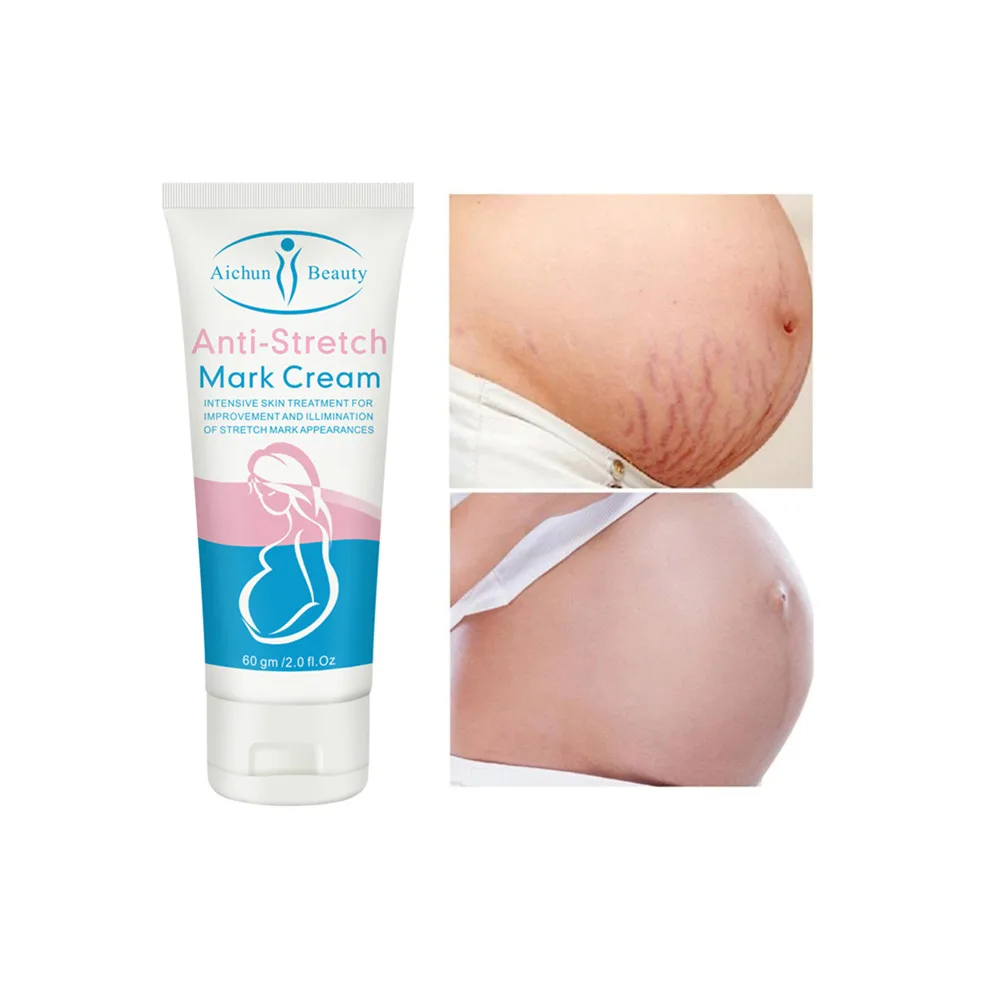 
Hot Sale Suitable All Skin Types Stretch Marks Removal Cream Stretch Mark 