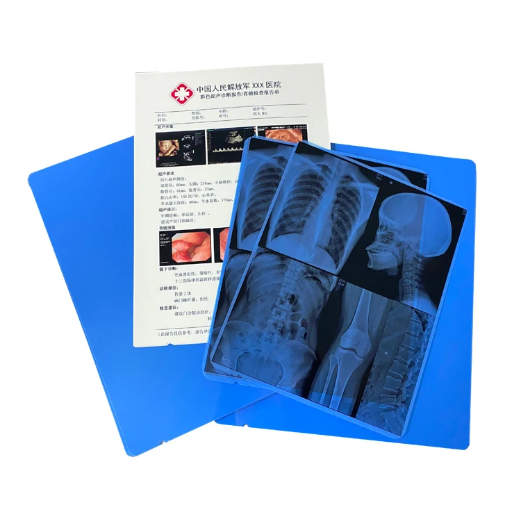 A4 White Ultrasound Inkjet Printable Dicom Medical Film