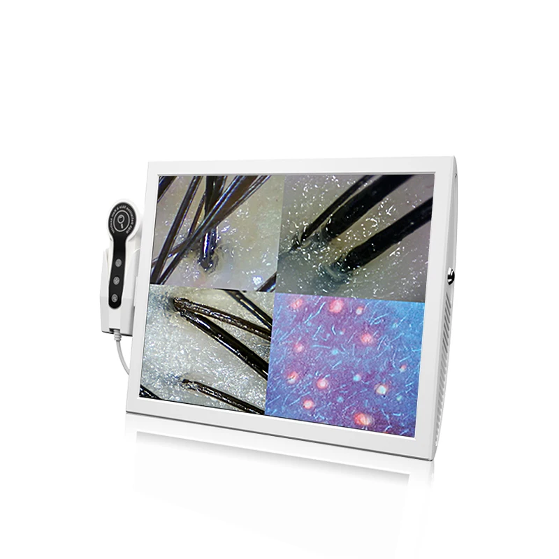 Portable HD Screen Withered Hair Loss Detector Scalp Analyzer / Skin And Analysis