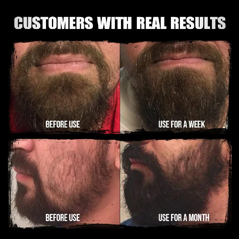 Oem HOT Custom Logo 100% Natural Organic Men Beard Oil Private Label Kit Set Growth Beard Oil