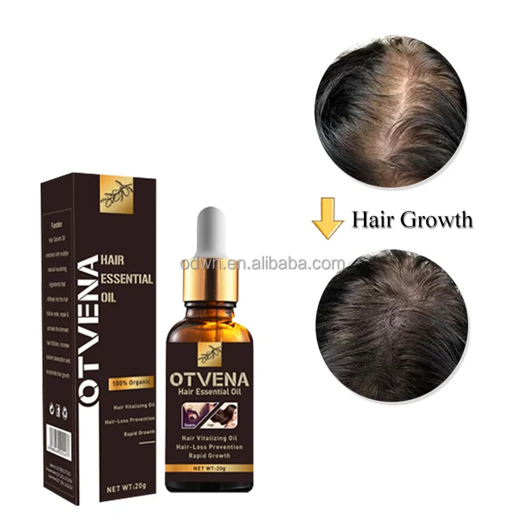 Hot Sale Thailand 20ml Hair lotion Growth Serum Oil Hair Loss Treatment Growth Hairs For Men Women