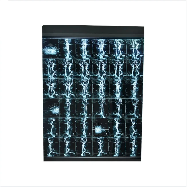 Medical Dry Film X-ray Film 210 Microns Inkjet Film Blue