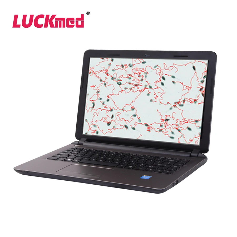 Veterinary Portable Vet Semen Quality CASA Analyzer Automatic Sperm Microscope Analysis Testing Minitube Machine