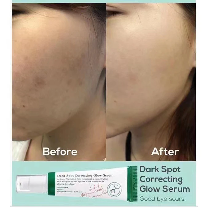 Dark spot correcting glow serum Niacinamide 5% lighten spots facial serum 50ml Spot Caring Repair Cream For All Skin Type