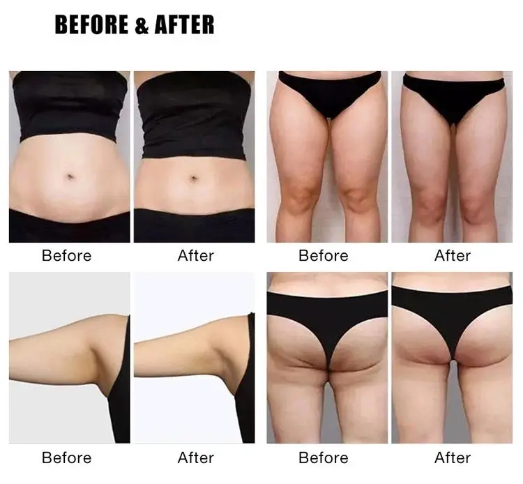  10 Tesla Hi новая Лепка emt EMSlim beauty slim EMS устройство для скульптурирования тела электрический стимулятор мышц ems похудения