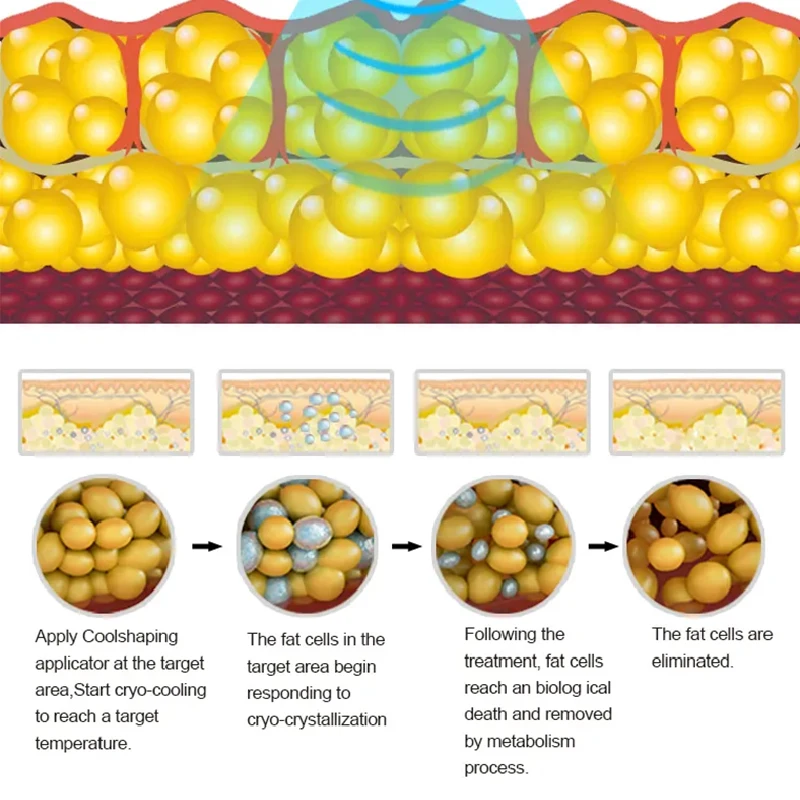 5 IN 1body slimming beauty equipment cryo cryotherapy t machine shock with 5 Handle Cool Technology 4.0 Face lifting Cool