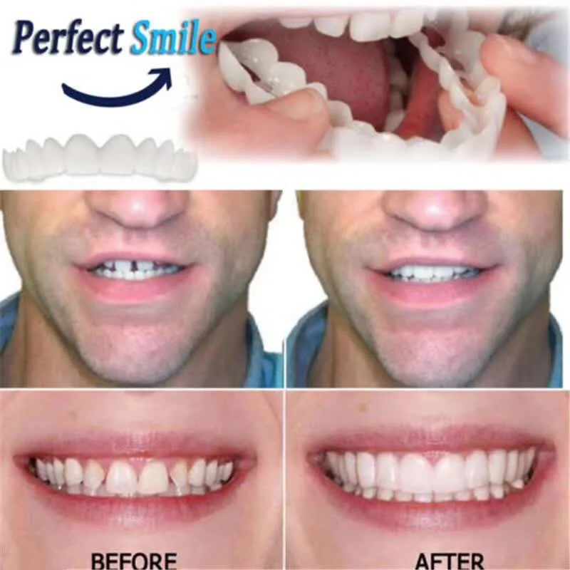 Upper and lower False teeth cover Perfect Smile Veneers Comfort Fit Flex Denture Paste fake braces for Double row of teeth