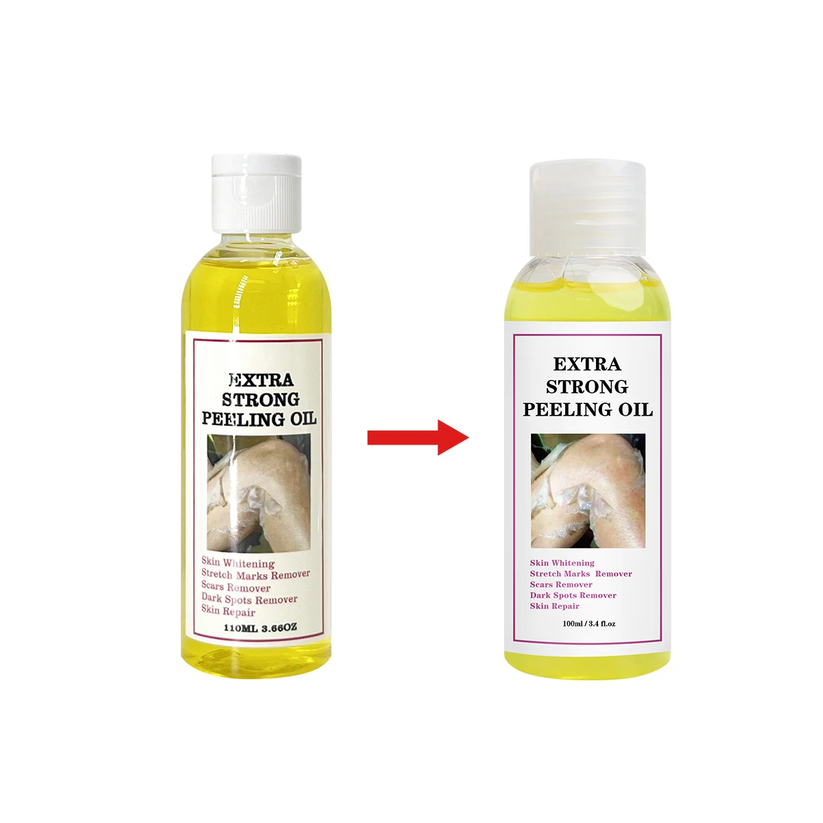 Private Label Extra Strong Whitening Dead Skin Dark Spot Remover Orange Peeling Oil Strength Yellow Bleaching Peel Oil