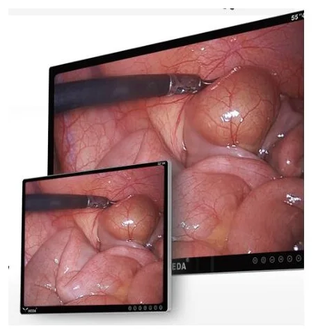 Medical Portable Endoscopy Machine AKX  YKD-9100H