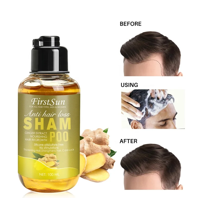 7 Days Ginger Hair Grower Hydrating Shampoo Anti Dandruff Herbal Against Hair Fall Private Label Hair Growth Shampoo