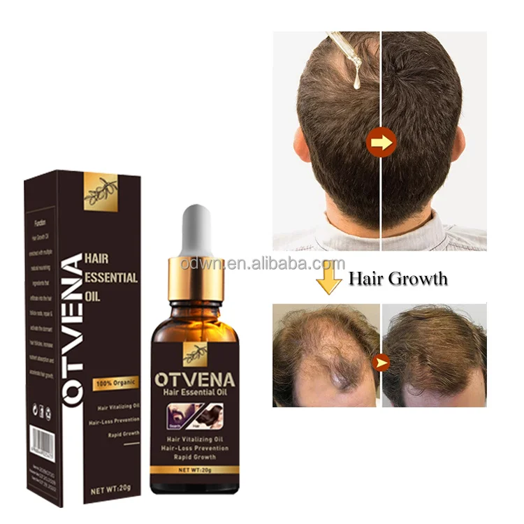 Hot Sale Thailand 20ml Hair lotion Growth Serum Oil Hair Loss Treatment Growth Hairs For Men Women
