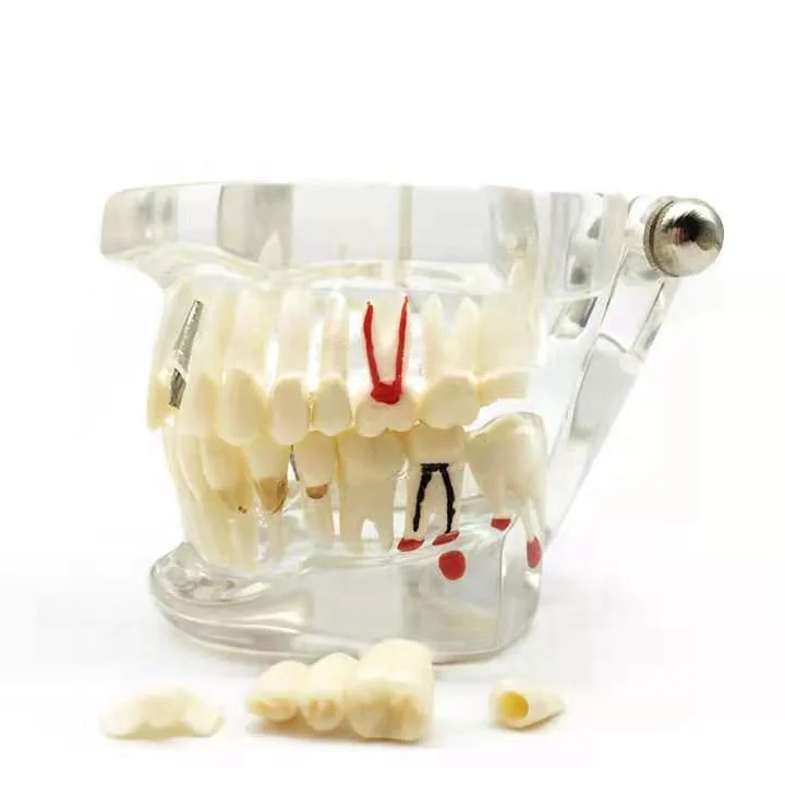 Dental Orthodontic Teach Study Teeth Model resin tooth molds