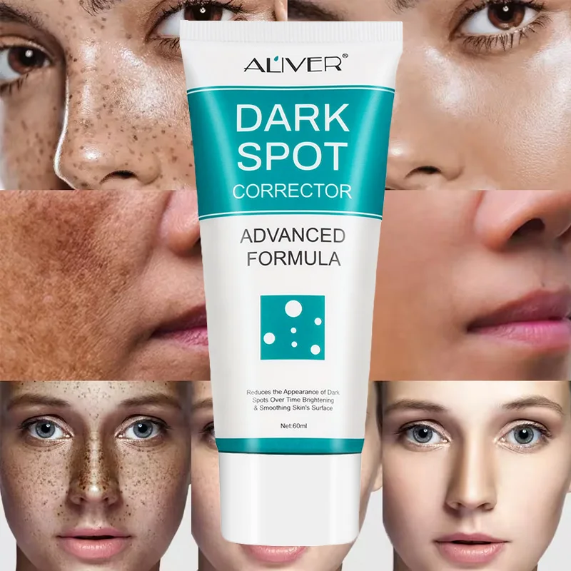 ALIVER Private Label Strong Effective Whitening Freckle Cream Removal Melasma Dark Spot Melanin Remover Brighten Skin Face Cream