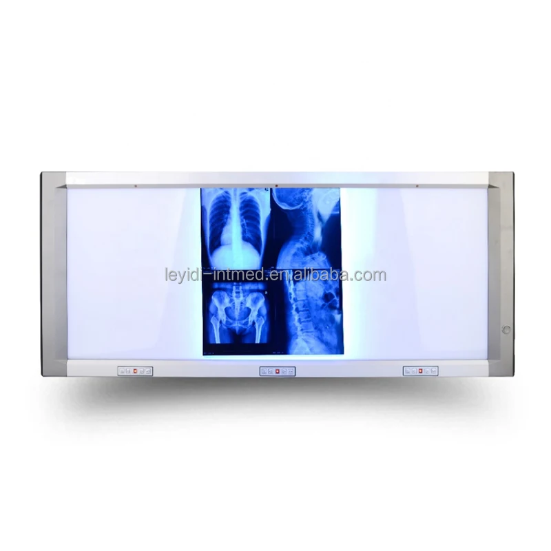 Quad Bank Radiaography Led X Ray Medical Negatoscope Film Viewer