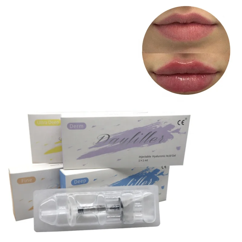 lip hyaluronic acid gel injections for buttocks/hyaluronic acid dermal filler injection/hyaluronic acid injection