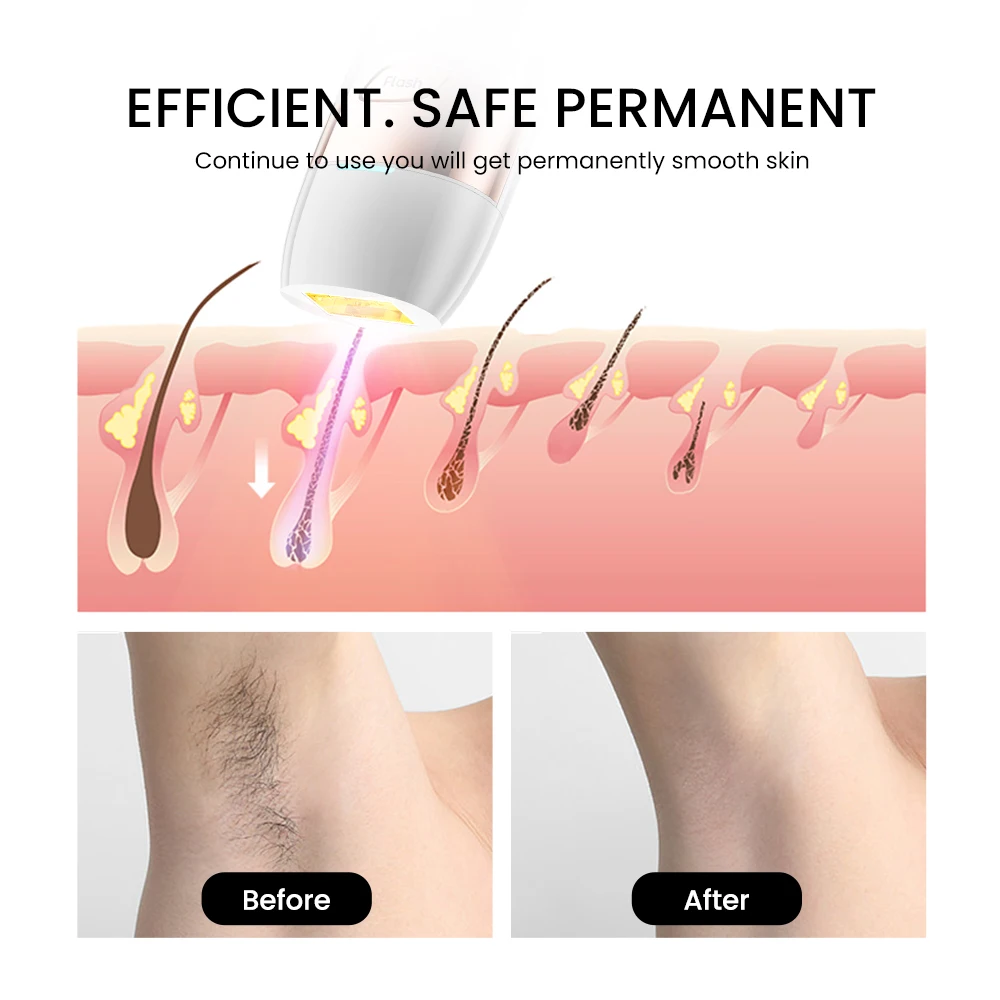 IPL Hair Removal for Women/Men ipl laser hair removal permanent hair removal pulse light epilator