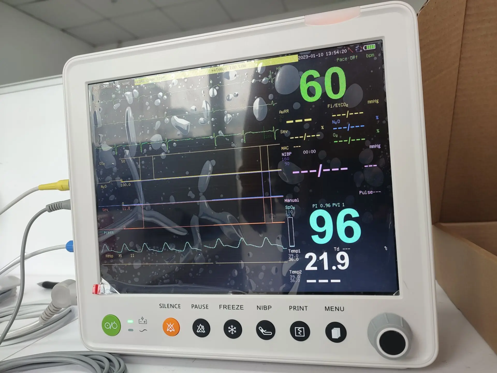 Medical Equipment 12 Inch  Vet CA600 Multi Parameter Veterinary Monitor ETCO2 Monitoring