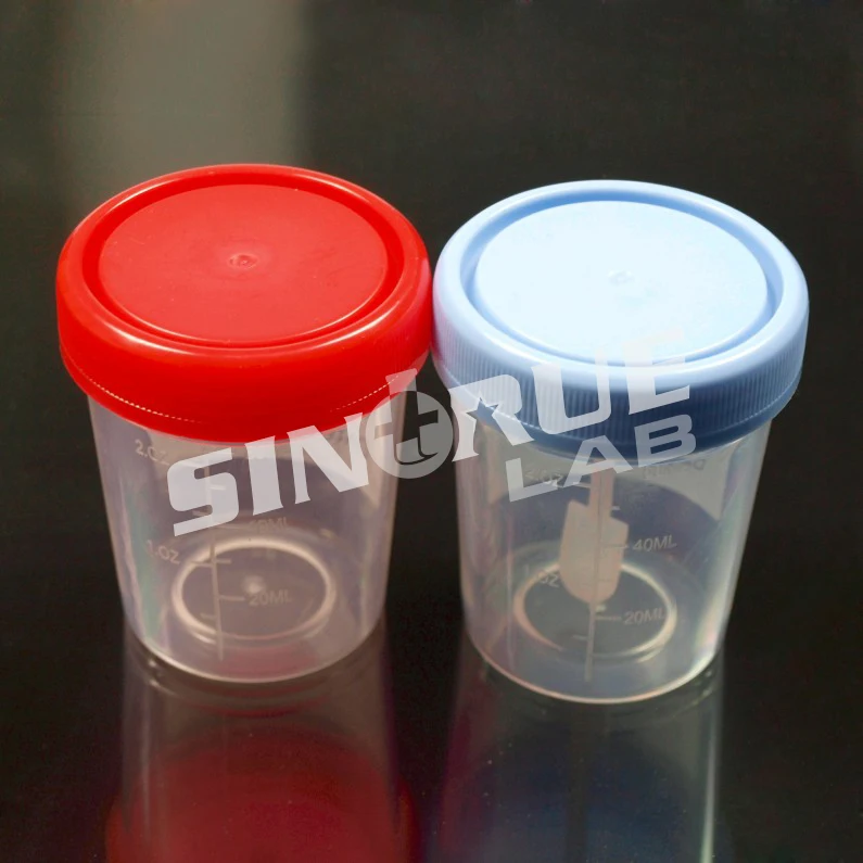 Lab Hospital 60ml Graduated Stool Container Urine Container with Screw Cap