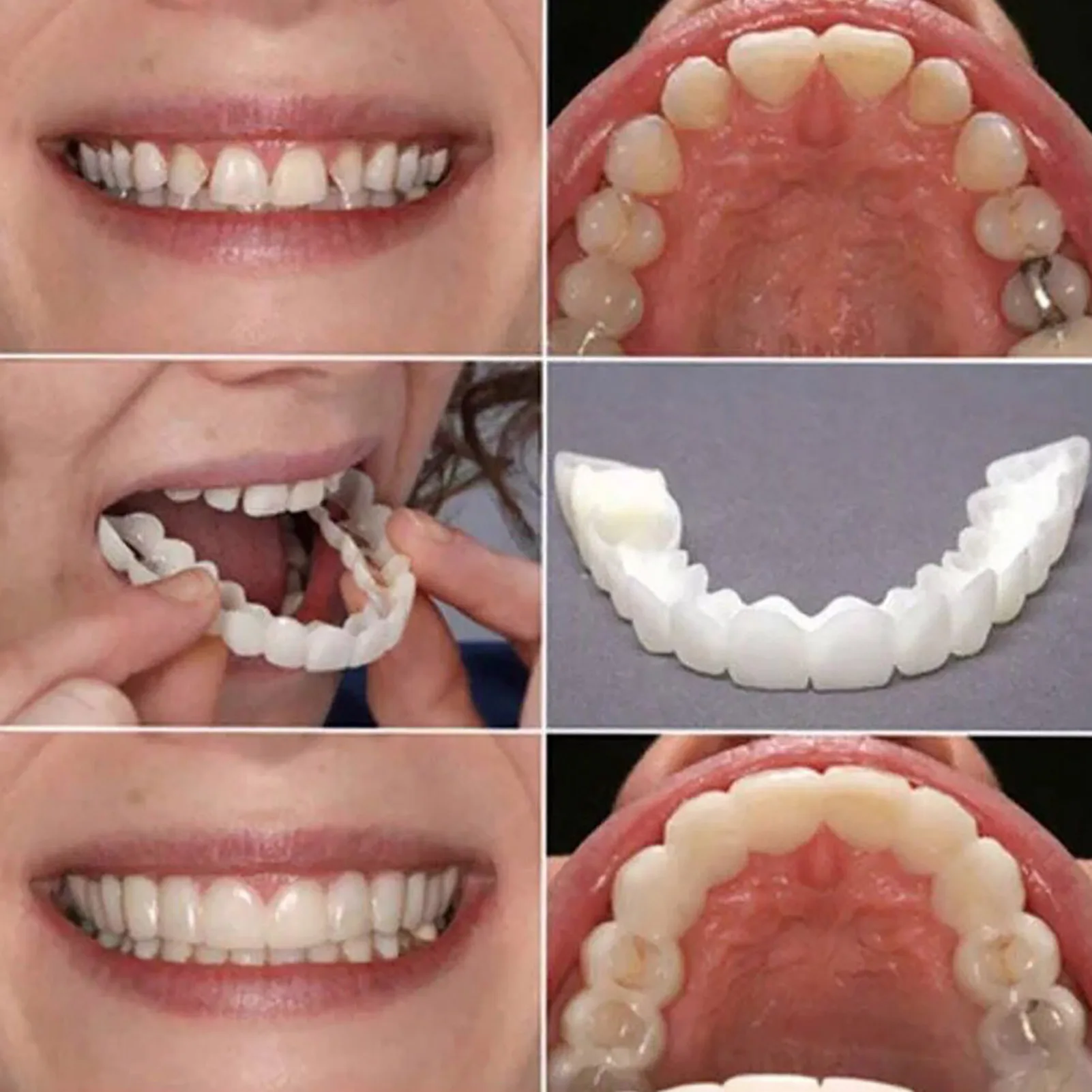 New snap smile customized label Upper lower False teeth cover Perfect Smile Veneers Comfort Fit Flex Denture braces