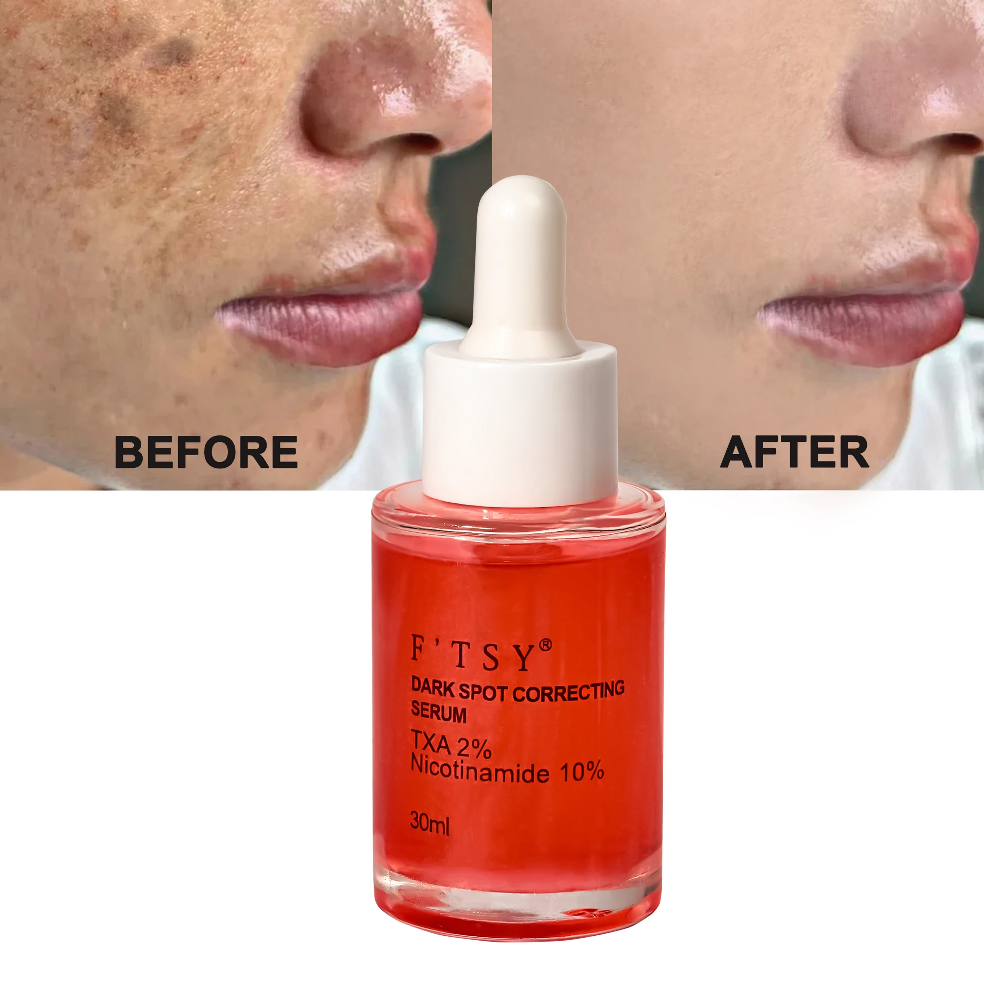 Organic Vegan Niacinamide Hyaluronic Acid Anti-Wrinkle Whitening Dark Spot Targeting Facial Serum 30ml OEM ODM Daily Use