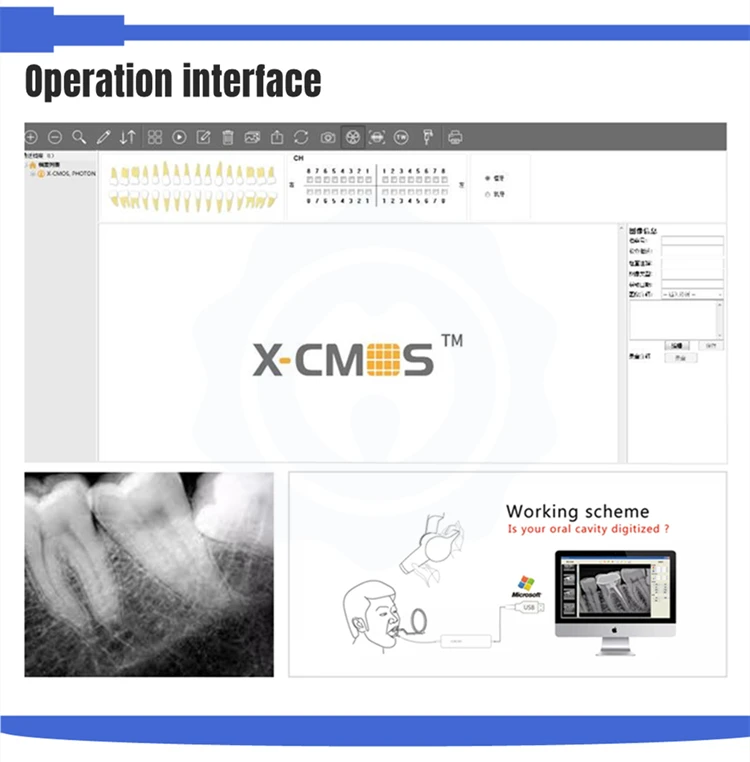 Преференциальная новая модель X-920B стоматологического рентгеновского датчика RVG оборудование для пероральной терапии и аксессуары стоматологов