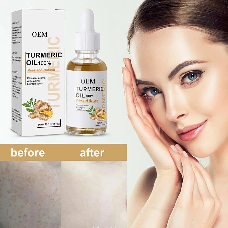 New Turmeric Essence Facial Essence Anti-Aging and Acne Mark Fade with Ginger Pure Essential Oil Gently Moisturizing Skin
