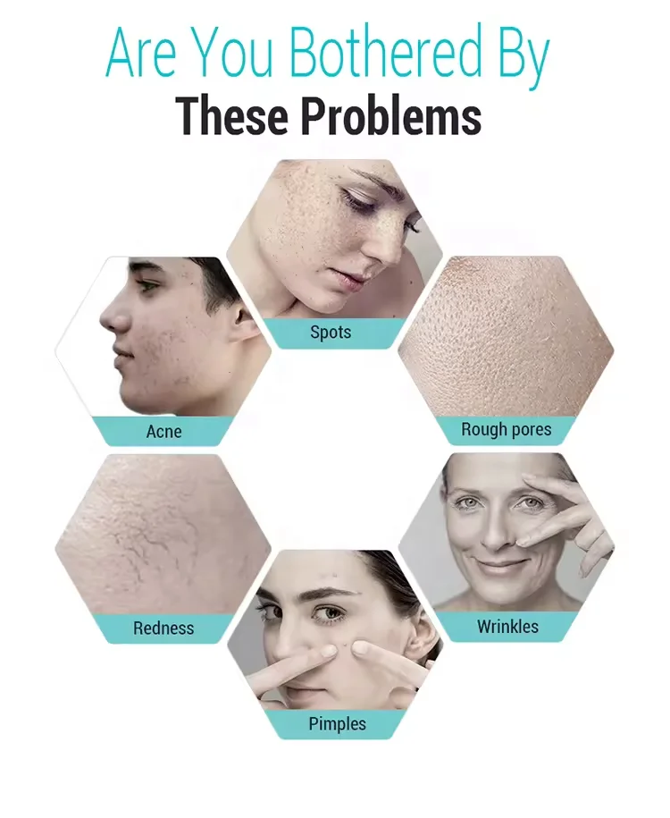 Beauty Salon 7 Color Photon Skin Rejuvenation Facial Beauty Pdt Led Light Therapy Machine